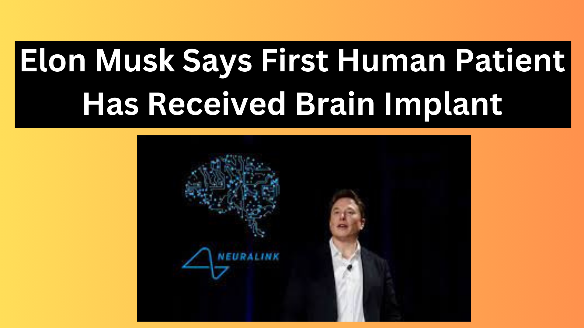 First Human Patient Receives Brain Implant, Says Musk