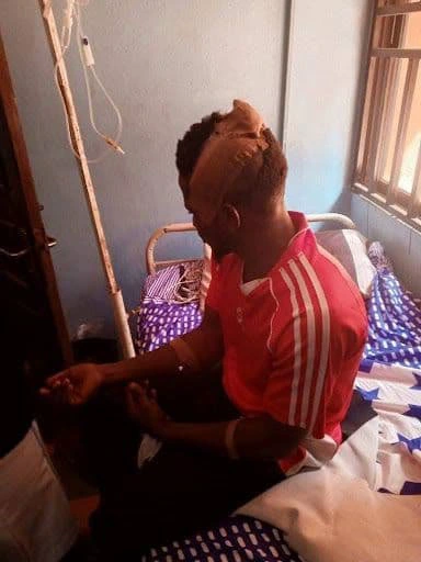 Female Tenant Breaks Landlord’s Head with Pestle after Receiving Quit Notice: Woman Arrested!